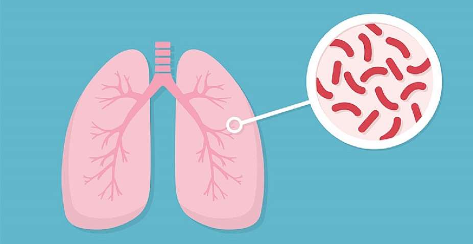 Ghana makes progress in Tuberculosis case detection and treatment