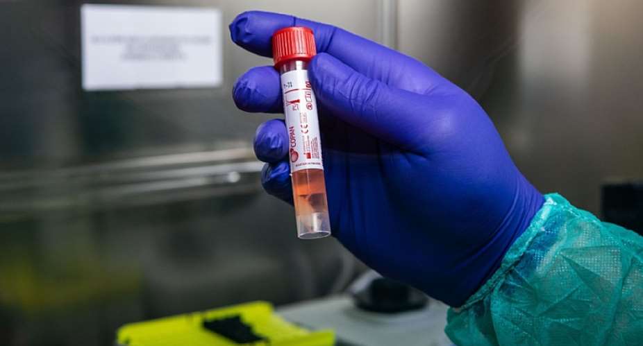 Coronavirus: Doctor At LEKMA Hospital Tests Positive