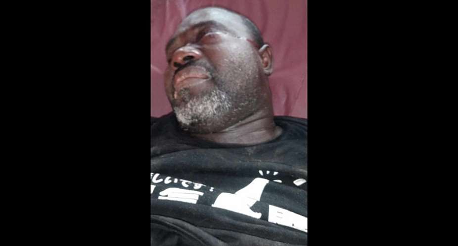 Talk show host Kasselee Sumo after he was assaulted on March 11, 2024, by two officers with the Liberia Drug Enforcement Agency and a magistrates court sheriff. Photo: Courtesy of Press Union of Liberia