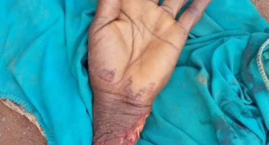 C/R: Mentally deranged man chops off a womans hand, injures six others at Ajumako-Badukrom