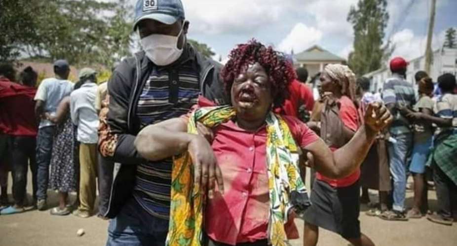 A lady was brutalized while fighting for mask and maize distributed by a local politician in Kenya's largest slum, Kibera.Photo courtesy: Fetus Chuma