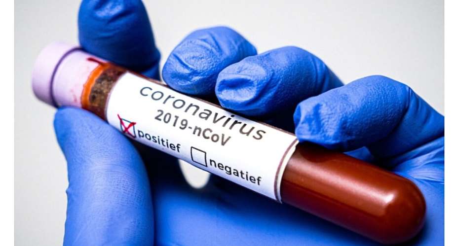 Coronavirus: Disabled Group Appeals For Support