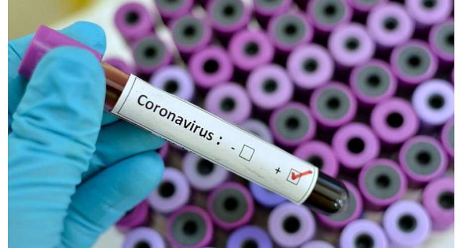 Exclusive: Djaba Family Relative Tests Positive For COVID-19 In The UK