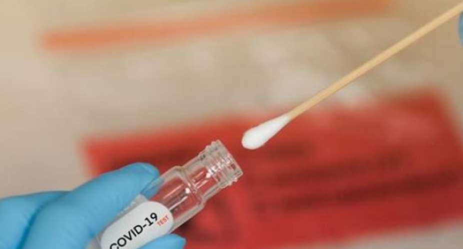 Covid-19: Ghana Conducts Over 80,000 Individual Tests — Noguchi Clarifies