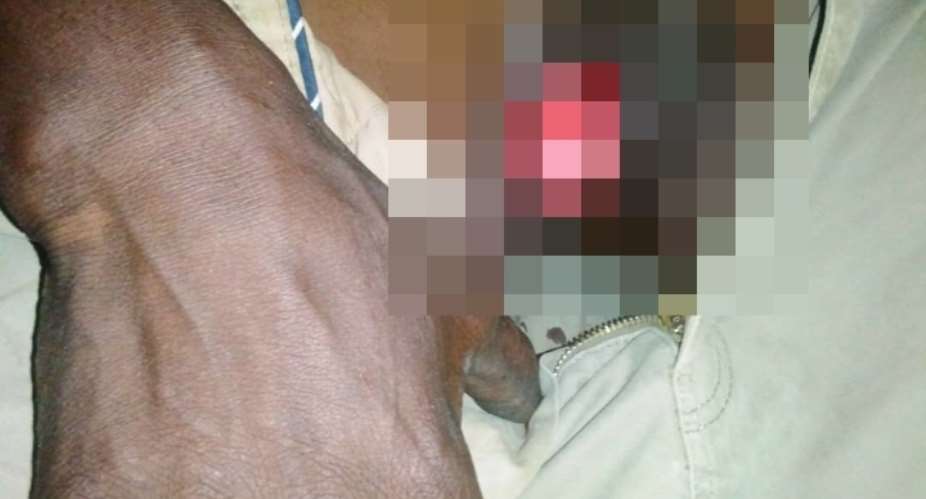 Man’s penis cut off in lover’s room by unidentified men during dumsor at Kwesimintsim