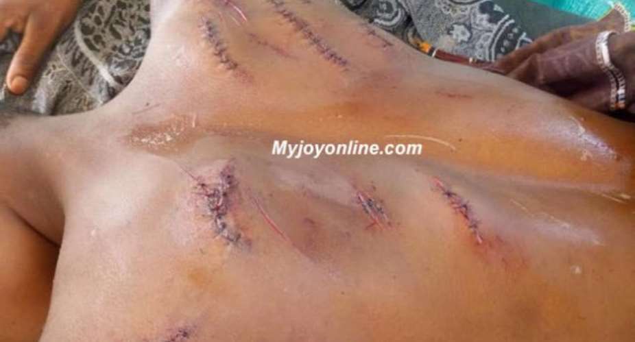 Teenage Twins Slashed After Allegedly Stealing GHC200