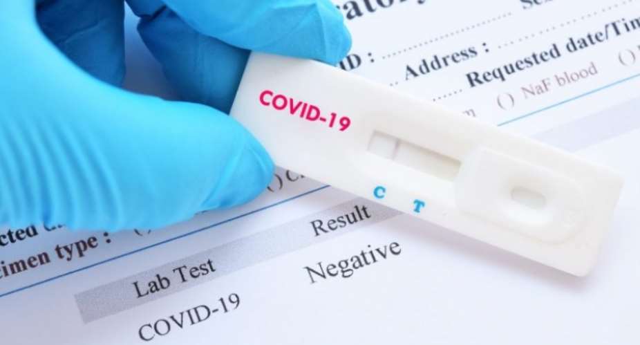 Covid-19: Noguchi, FDA Expected To Finish Assessment Of Rapid Test Kits This Week