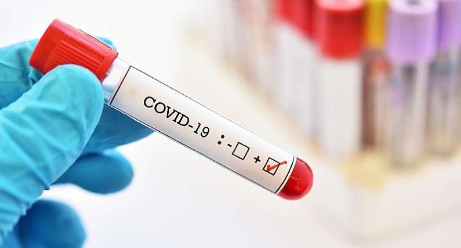 Oti Region: 8 Out Of 17 Cases Of COVID-19 Being Managed
