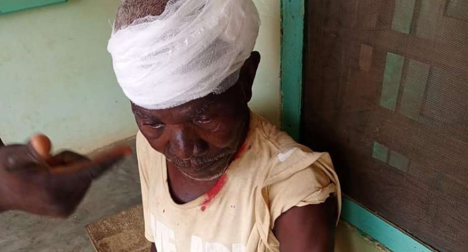 A 65-year-old Isaac Ackom, who sustained a severe head injury during an unannounced blast from the quarry