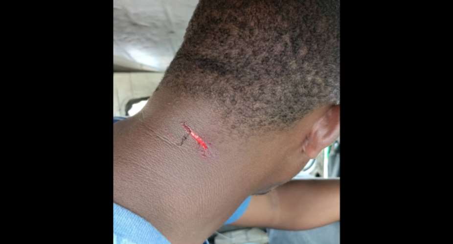 Wave FM Zambia journalist Hope Chooma was attacked by ruling United Party for National Development (UPND) supporters while covering a charity event in the southern town of Mazabuka. (Photo: Courtesy of Hope Chooma)