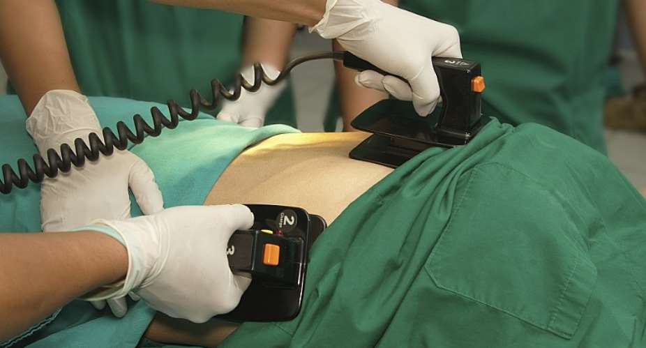 Ghana lack defibrillators in hospitals, its a crime – Korle Bu Neurosurgeon fumes