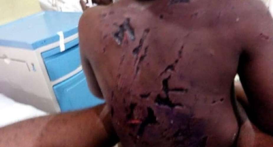 His Father Bites Me When We Quarrel; Let Him Go To Jail – Mother of 3-yr-old Abused Boy