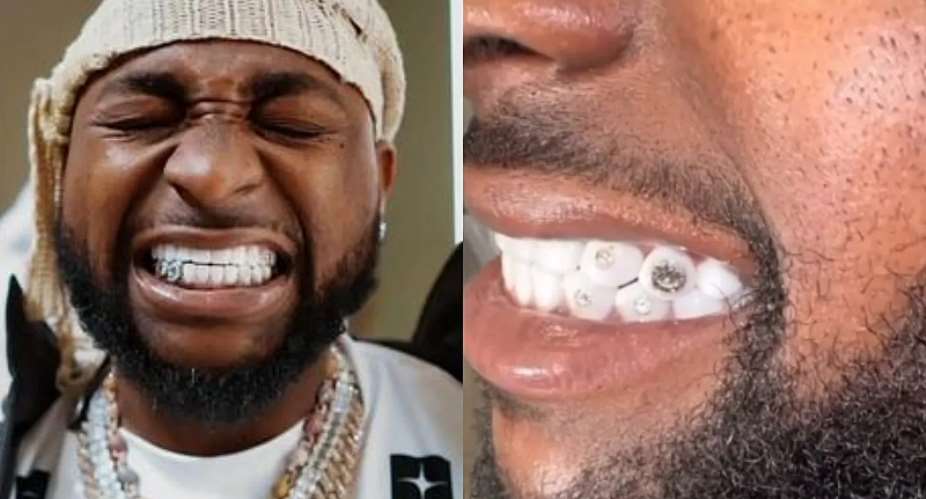 Davido flaunts $2 Million chain and $500,000 diamond teeth in viral video