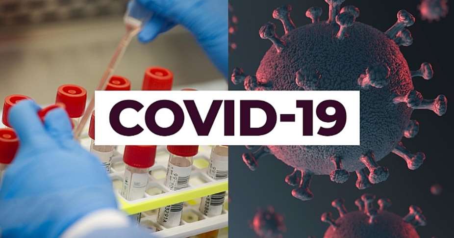 COVID-19: Cases Hit 5,735