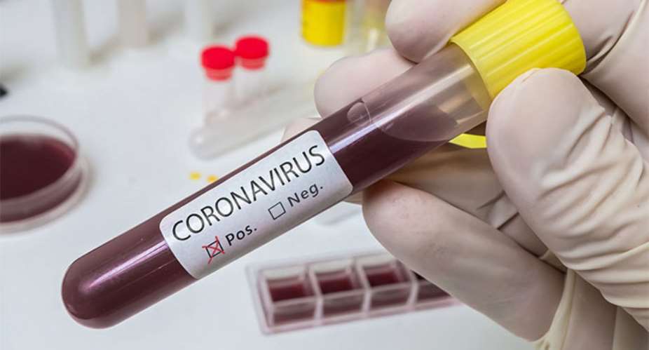 Covid-19: Africas Cases Hit 84,634