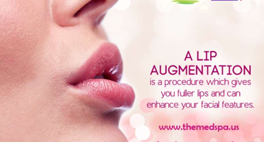 lip augmentation in delhi by dr. ajaya kashyap