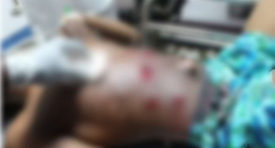 Fresh shooting shatters fragile calm in Nkwanta South, Okada rider shot
