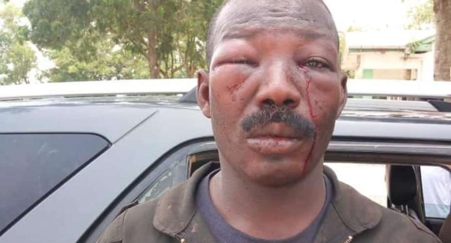 Amasaman Residents Beat Police Officer To Pulp