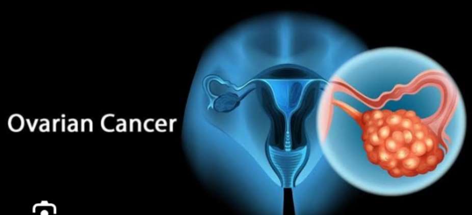 No Woman Left Behind: World Ovarian Cancer Day 2026 A Call to Action for Ghana and West Africa