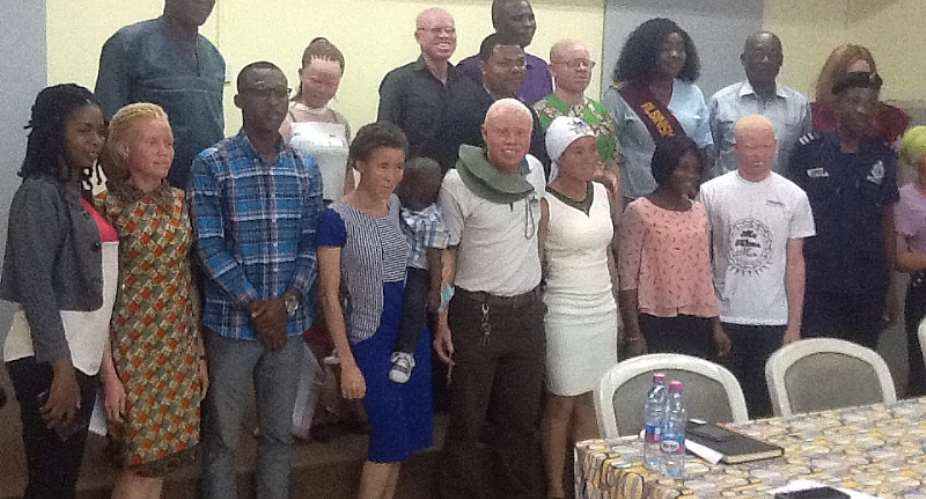 2012 TV3's GMB Winner Appointed Ambassador Of Persons With Albinism