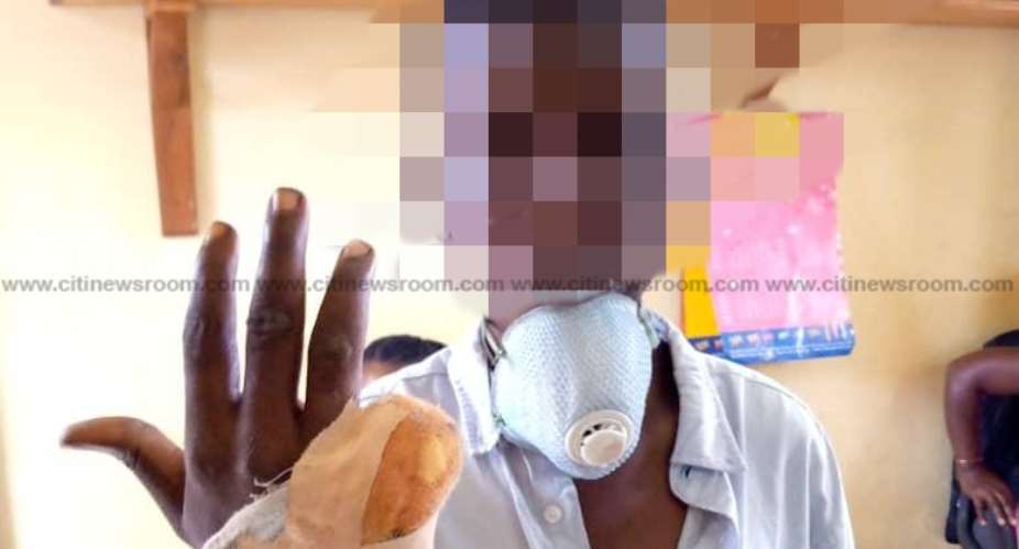 Takoradi: Court Cages Mallam For Slashing Finger Of Suspected Thief