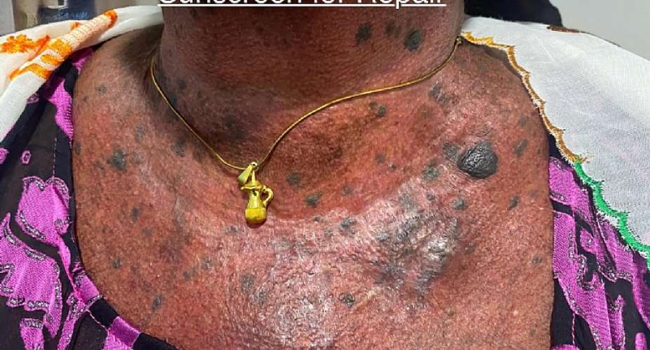 Girls are bleaching not just their faces, but their confidence – Dr Brifo