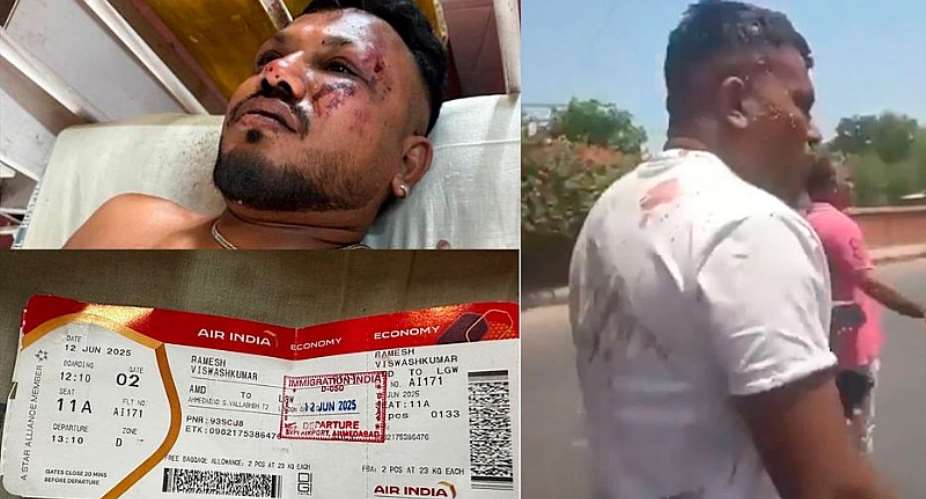 Ramesh Viswashkumar’s Survival: A Living Proof That God Still Works Miracles