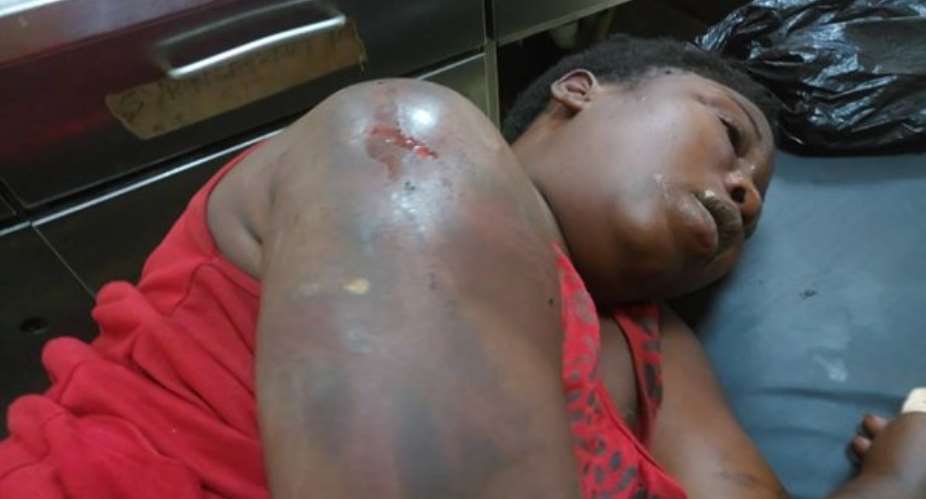 Kumasi: 22-Year-Old Lady Battles For Life After Police Brutality