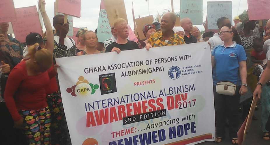 GAPA Celebrates International Albinism Awareness Day