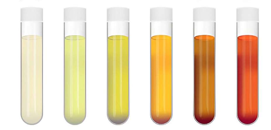 Why Pee (Urine) Changes Colour: Is It Healthy?