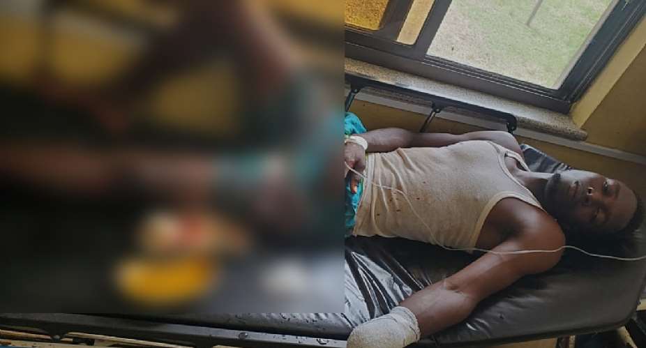 Ada: Okada rider chops off farmer’s hand over misunderstanding at Amlakpo