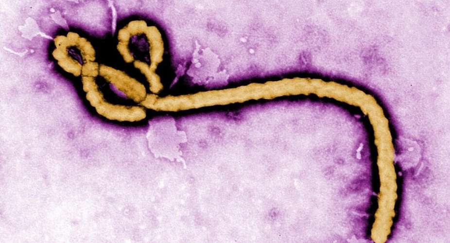 FILE - This undated colorized transmission electron micrograph file image made available by the Centers for Disease Control and Prevention (CDC) shows an Ebola virus virion -  Frederick Murphy / AP