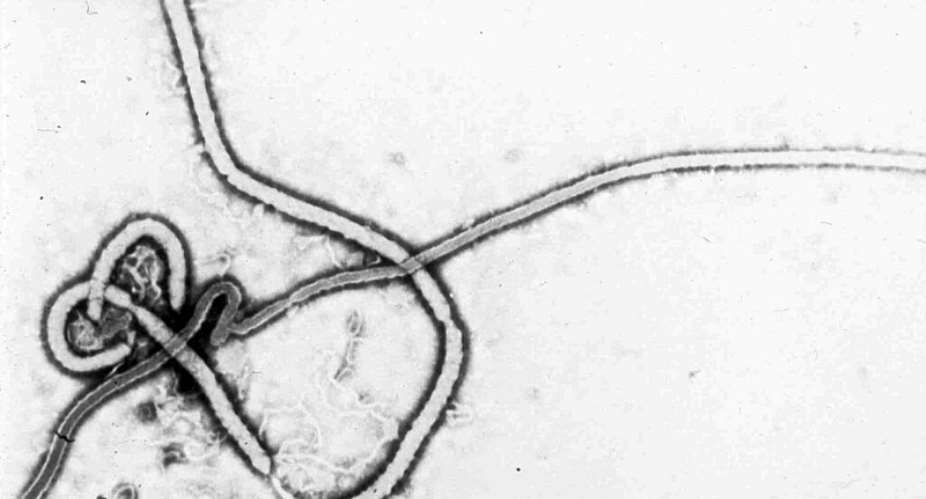 This undated electron micrograph image provided by the Centers for Disease Control and Prevention on May 11, 1995 shows the Ebola virus. - AP