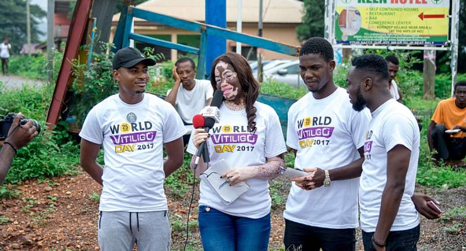 Keeny Ice Joins Vitiligo Awareness Campaign In HO