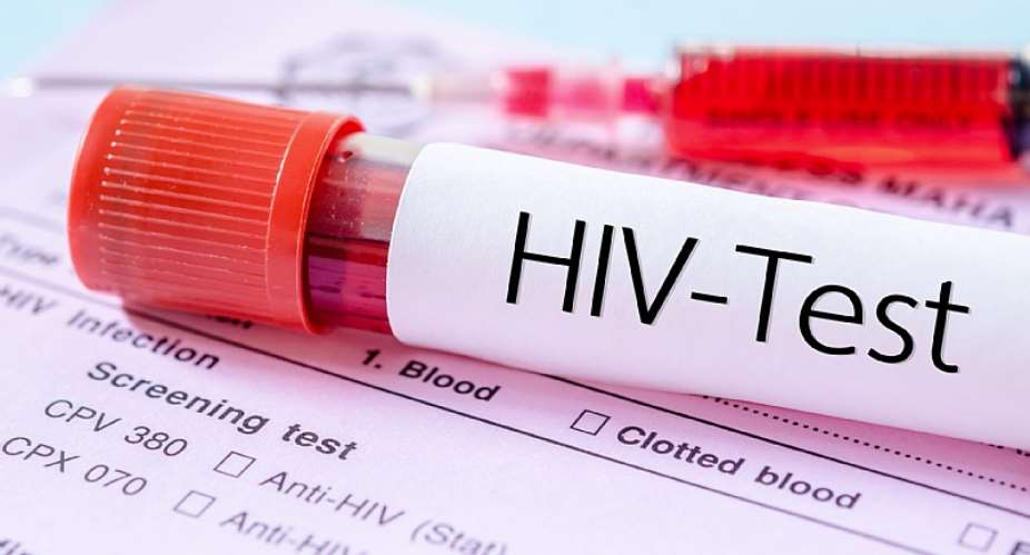Petty traders record highest infection rate in community HIV self testing project - GHANET