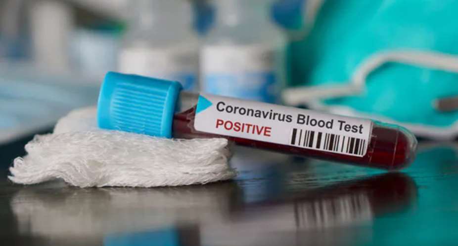 Coronavirus: Some School Staffs Including 55 Students, Test Positive