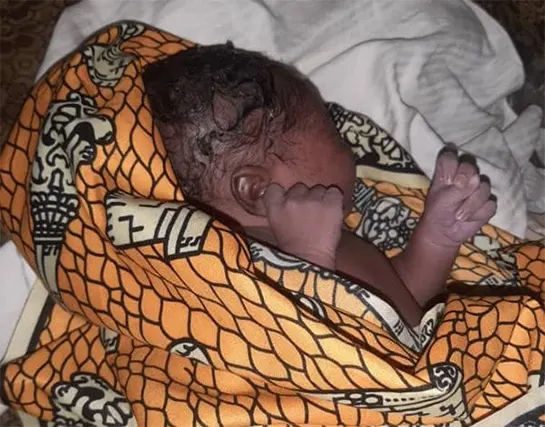 The abandoned baby