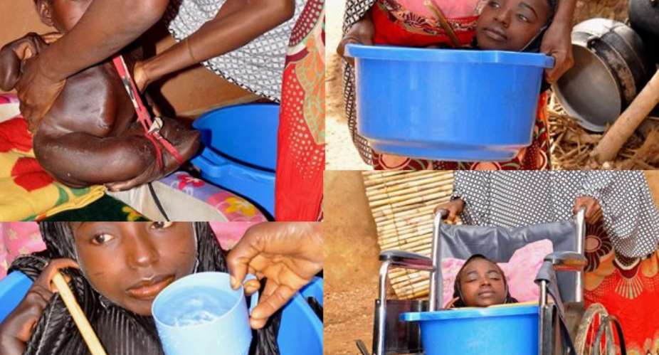 Meet the girl born with no arms or legs who lives in a plastic bowl