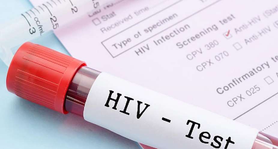One in every three Ghanaians living with HIV unaware — AIDS Commission
