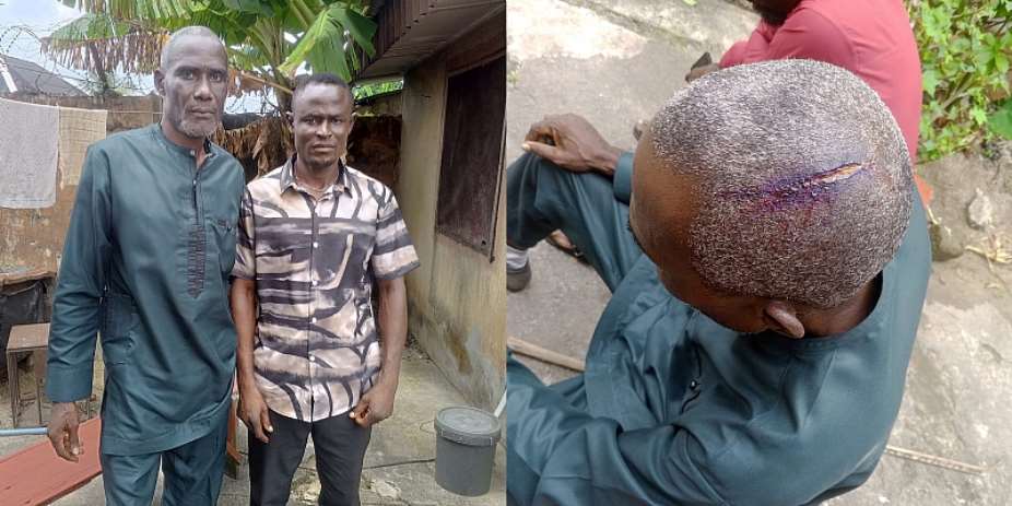 Alleged Penis Theft and Forced Confession in Rivers State