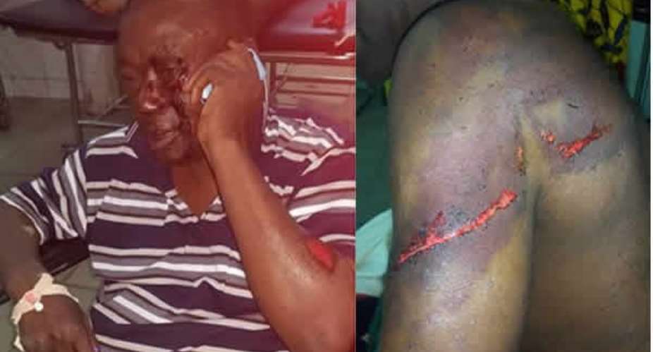 Nana Kwasi Agyemang IX was brutalised by men allegedly hired by Nana Hema Dekye
