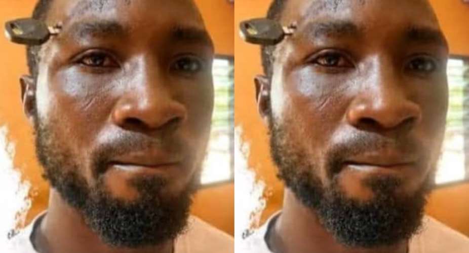 Doctors remove motorbike key from farmers skull after attempting to separate fight at Amenyo