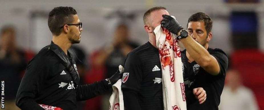 Wayne Rooney Scores First DC United Goal And Breaks Nose In Win Over Colorado Rapids