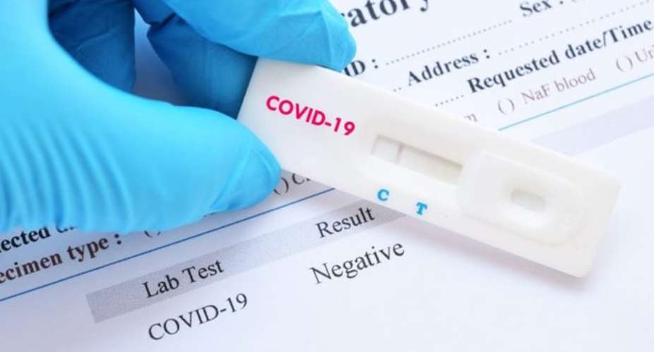 FDA Must Review Mode Of Validating COVID-19 Rapid Test Kits – Medical Laboratory Scientists