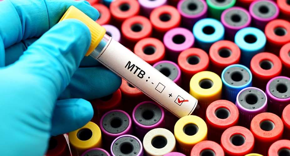New remedies are needed as rates of multi-drug resistant TB rise. - Source: Jarun OntakraiShutterstock