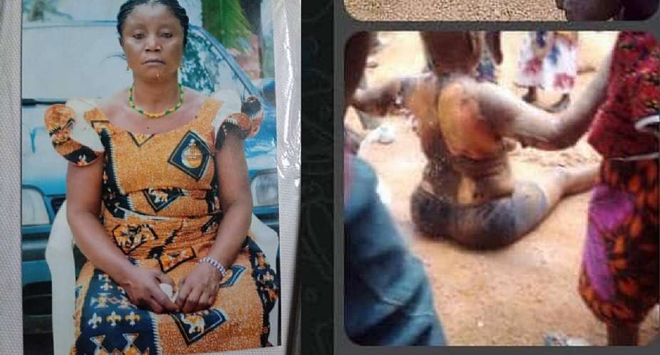 Woman Accused of Witchcraft and Set Ablaze By Son Passes Away in Calabar Cross River State