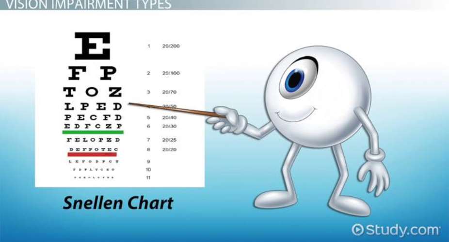 Snellen Chart. Image by Study.com