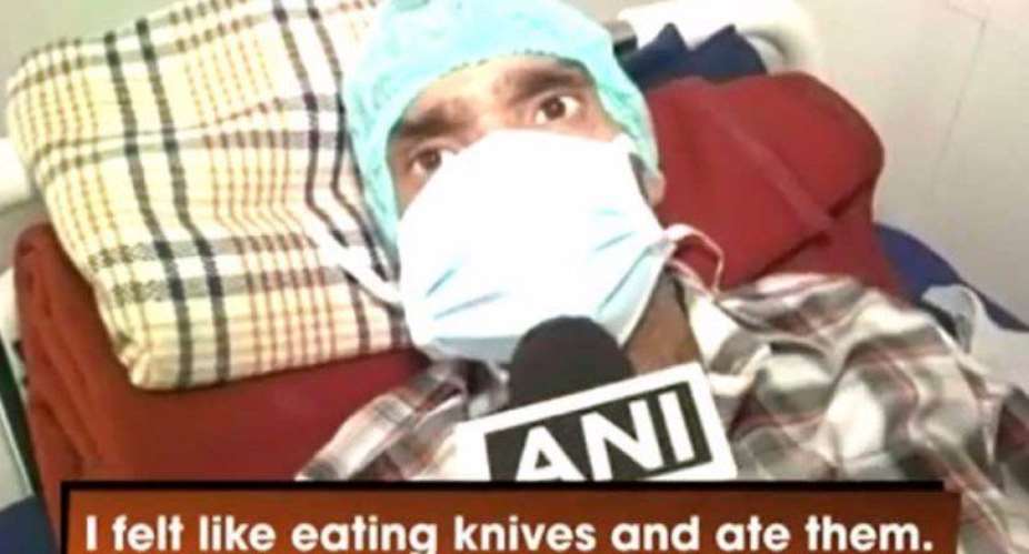 Man who swallowed 40 knives shockingly lives to tell story