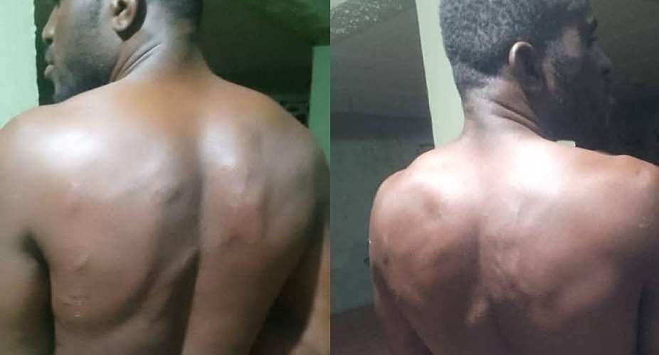 Sandema carpenter hospitalized after alleged military brutality for calling on govt to fix Chuchuliga-Sandema-Wiesi road