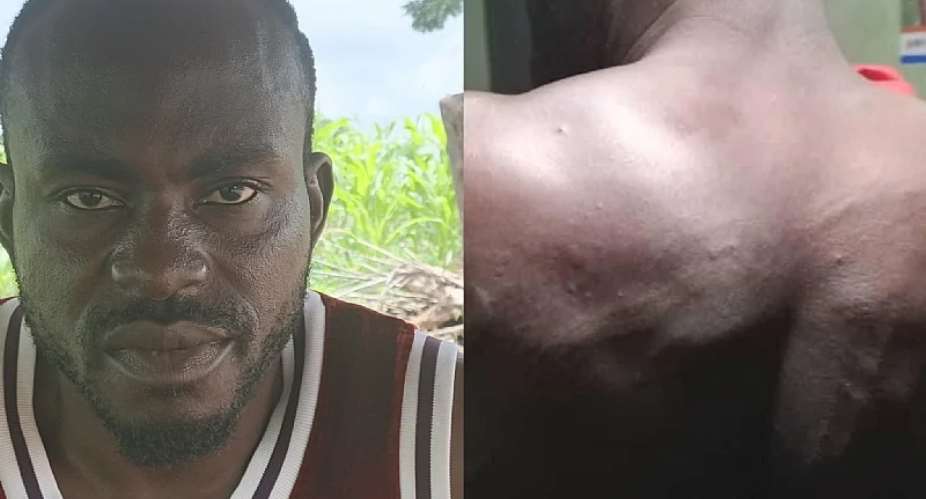 Mr. Ateng Awonyaami Fidelis allegedly beaten by military personnel
